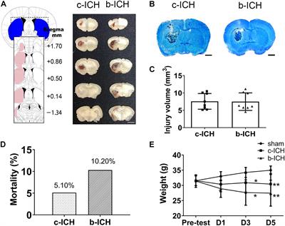 Profiling of Blood-Brain Barrier Disruption in Mouse Intracerebral Hemorrhage Models: Collagenase Injection vs. Autologous Arterial Whole Blood Infusion